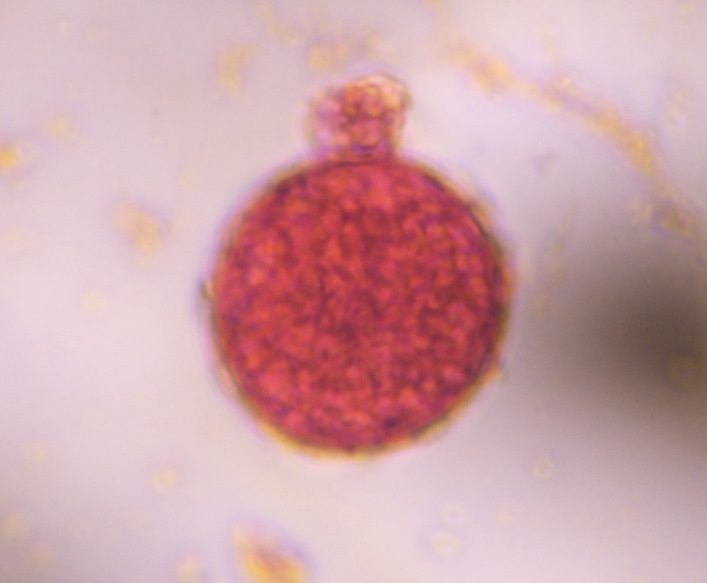 Chenopod pollen under a microscope, verified by PollyMap