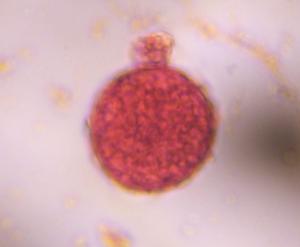 Chenopod pollen under a microscope, verified by PollyMap