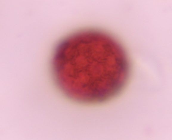 Chenopod pollen under a microscope, verified by PollyMap