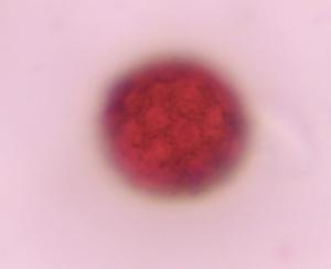 Chenopod pollen under a microscope, verified by PollyMap
