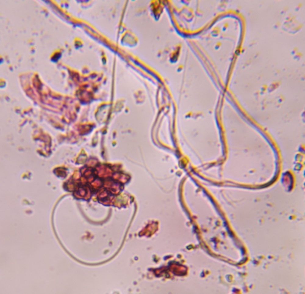 Epicoccum mold spore under a microscope, verified by PollyMap