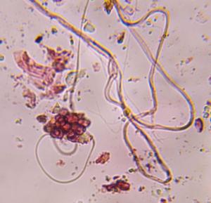 Epicoccum mold spore under a microscope, verified by PollyMap