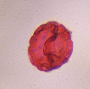 Chenopod pollen under a microscope, verified by PollyMap
