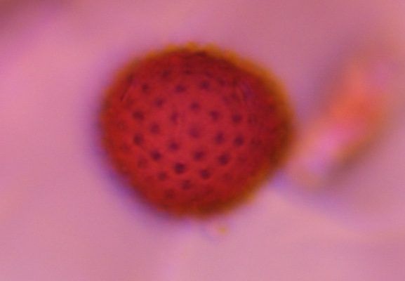 Asteraceae pollen under a microscope, verified by PollyMap