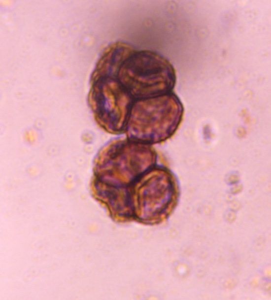 Microscope image of Unknown dematiaceous mold, verified by PollyMap