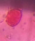 unidentified pollen under a microscope, verified by PollyMap