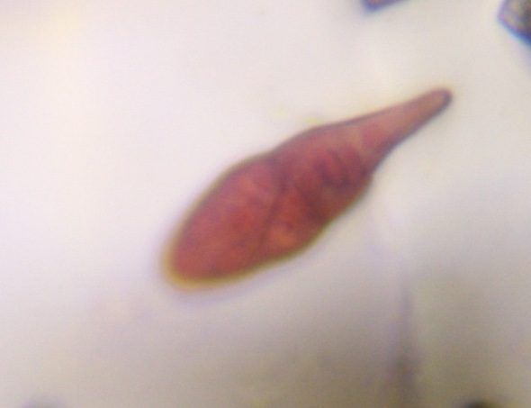 Alternaria mold spore under a microscope, verified by PollyMap