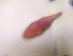 Alternaria mold spore under a microscope, verified by PollyMap