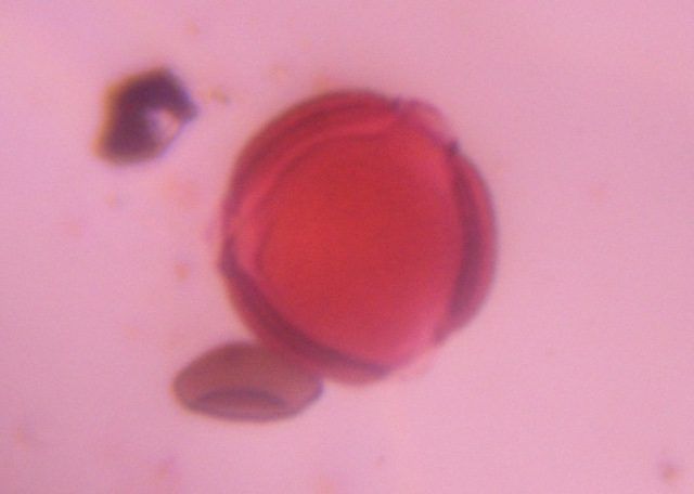 Artemisia pollen under a microscope, verified by PollyMap