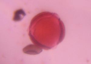 Artemisia pollen under a microscope, verified by PollyMap