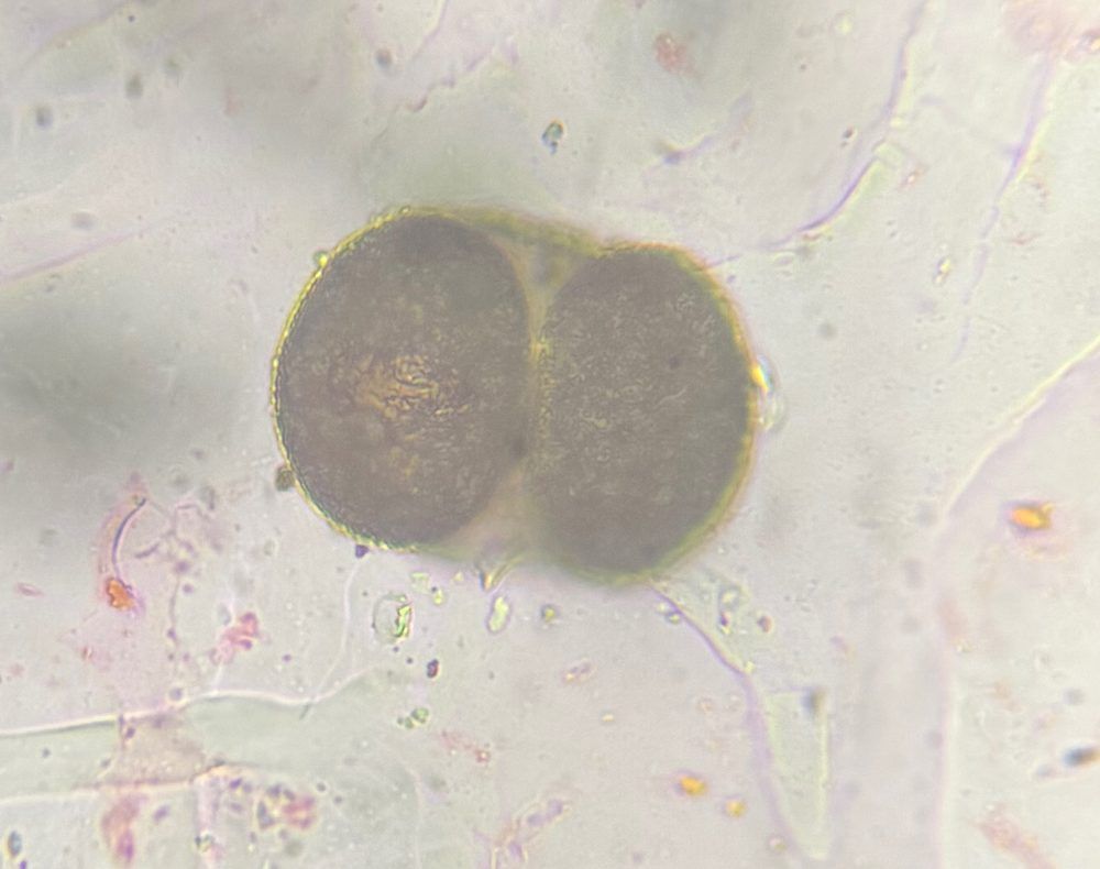 Another microscope image of Pine, verified by PollyMap