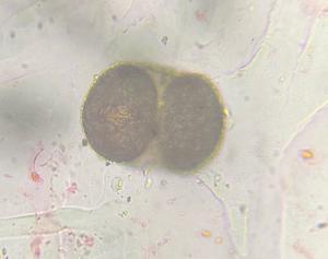 Pine pollen under a microscope, verified by PollyMap