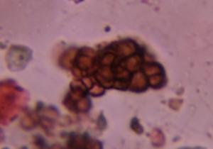 Epicoccum mold spore under a microscope, verified by PollyMap