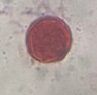 Grass pollen under a microscope, verified by PollyMap