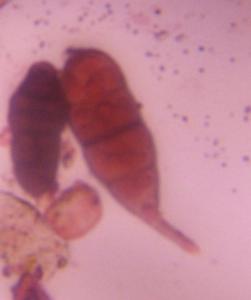 Alternaria mold spore under a microscope, verified by PollyMap