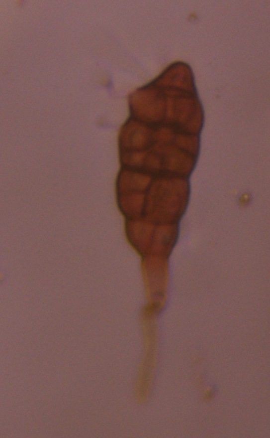 Alternaria mold spore under a microscope, verified by PollyMap