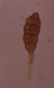 Alternaria mold spore under a microscope, verified by PollyMap