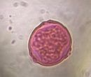 Mulberry pollen under a microscope, verified by PollyMap