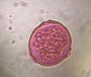 Mulberry pollen under a microscope, verified by PollyMap