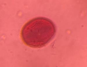 Oak pollen under a microscope, verified by PollyMap