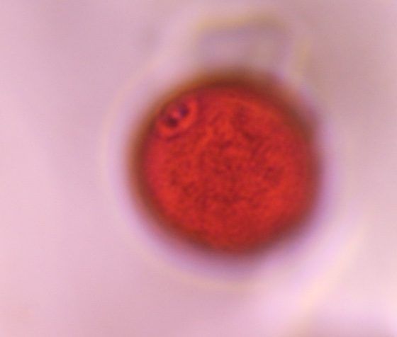 Poaceae pollen under a microscope, verified by PollyMap