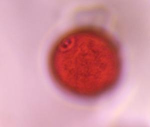 Poaceae pollen under a microscope, verified by PollyMap