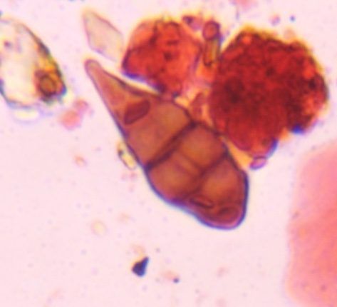 Another microscope image of Alternaria, verified by PollyMap