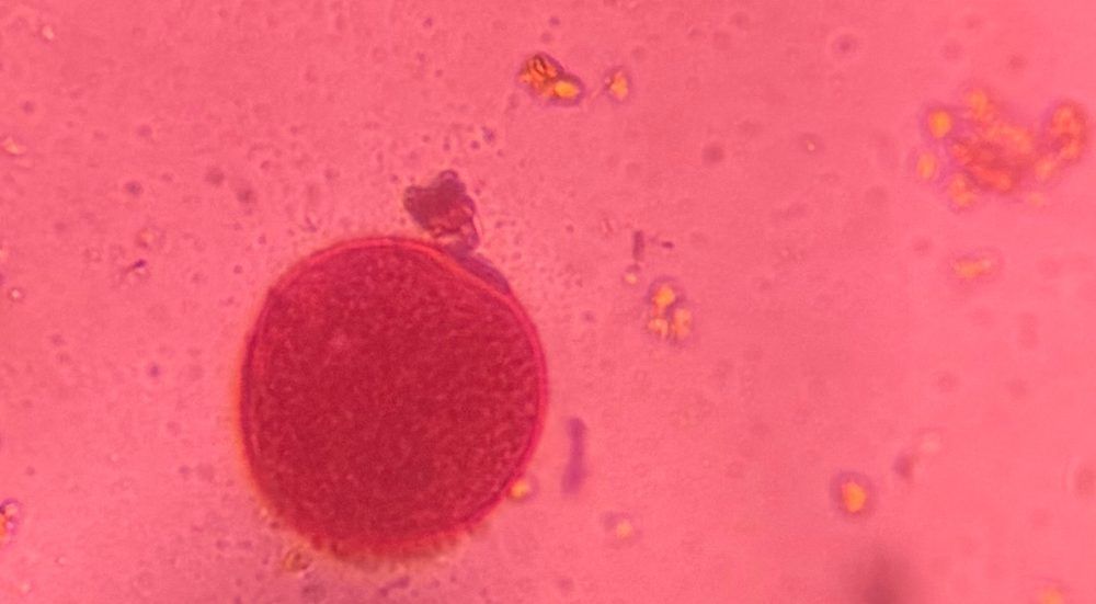 Grass pollen under a microscope, verified by PollyMap