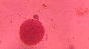 Grass pollen under a microscope, verified by PollyMap