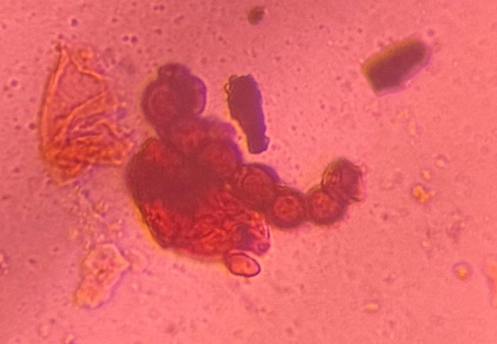 Torula mold spore under a microscope, verified by PollyMap