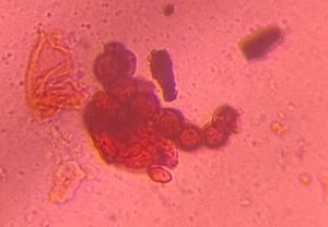 Torula mold spore under a microscope, verified by PollyMap