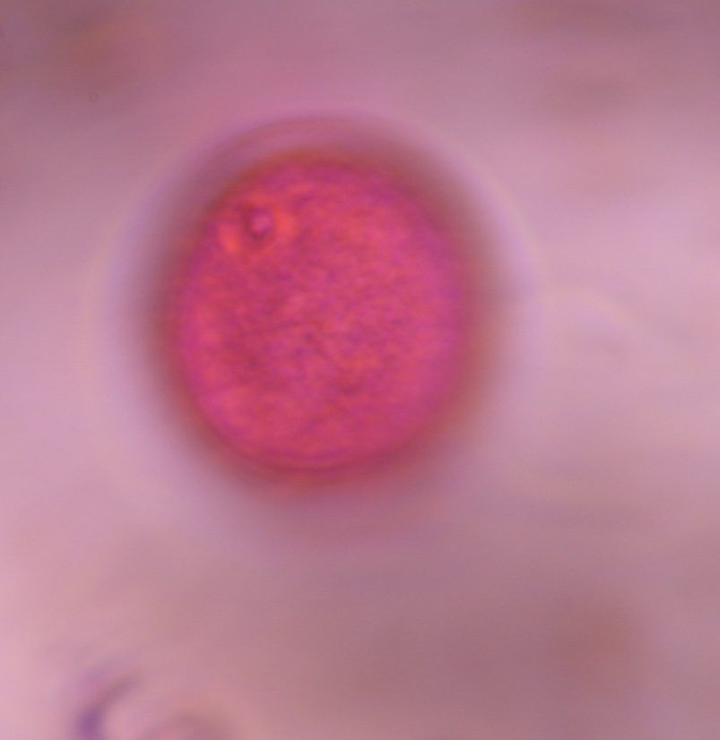 Poaceae pollen under a microscope, verified by PollyMap