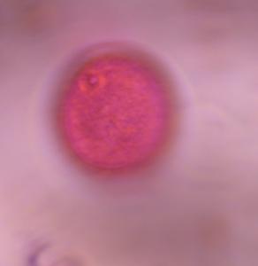 Poaceae pollen under a microscope, verified by PollyMap
