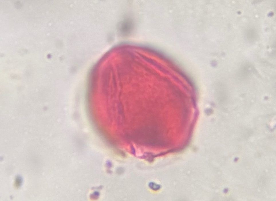 Another microscope image of Artemisia, verified by PollyMap
