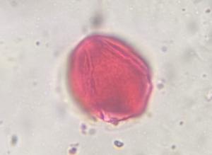 Artemisia pollen under a microscope, verified by PollyMap