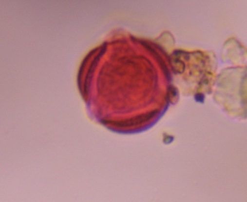 Another microscope image of Artemisia, verified by PollyMap
