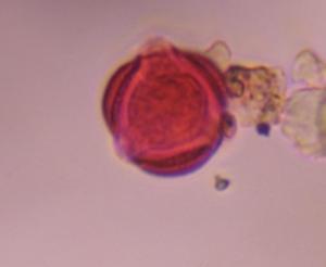 Artemisia pollen under a microscope, verified by PollyMap