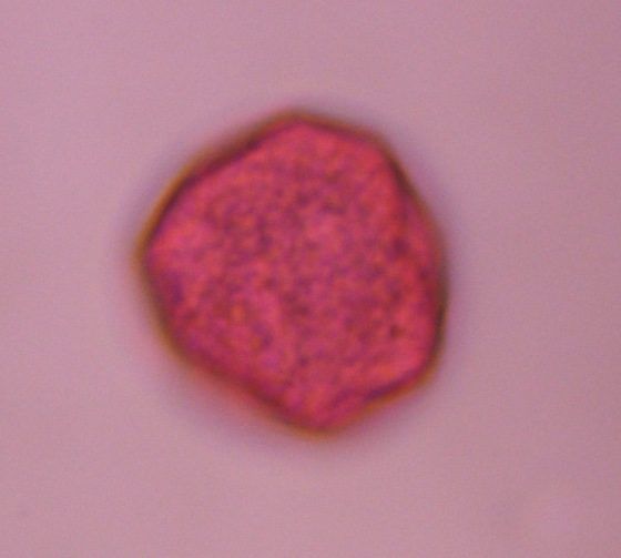 Chenopod pollen under a microscope, verified by PollyMap