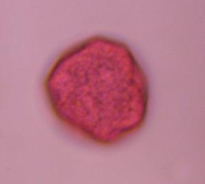 Chenopod pollen under a microscope, verified by PollyMap