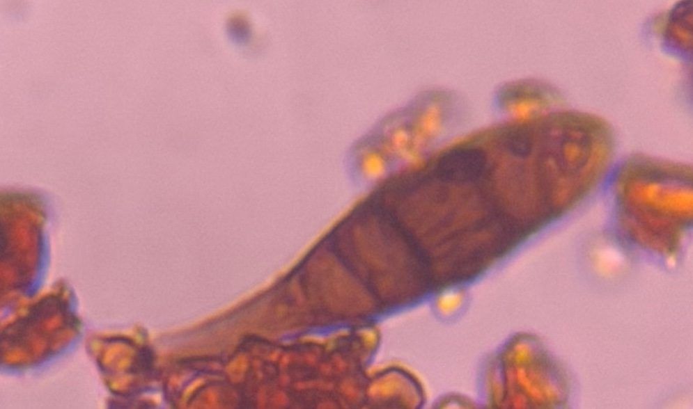 Another microscope image of Alternaria, verified by PollyMap