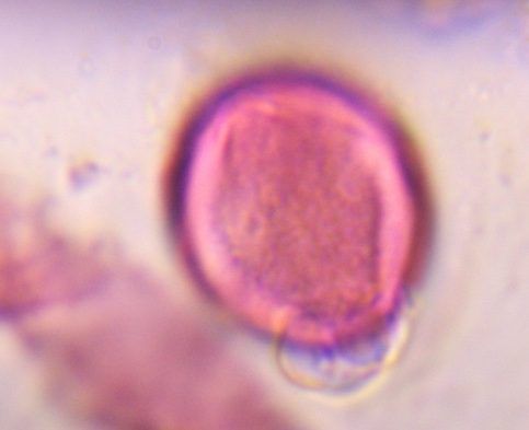 Artemisia pollen under a microscope, verified by PollyMap