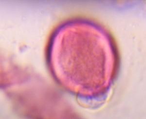 Artemisia pollen under a microscope, verified by PollyMap