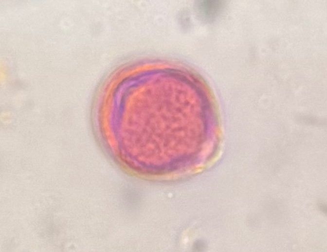 Another microscope image of Artemisia, verified by PollyMap