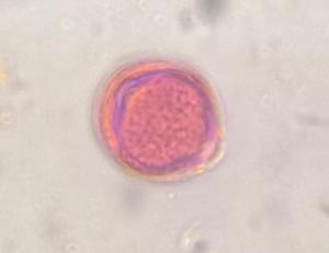Artemisia pollen under a microscope, verified by PollyMap