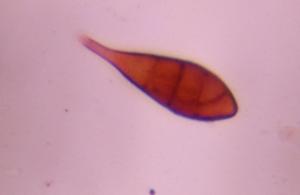 Alternaria mold spore under a microscope, verified by PollyMap