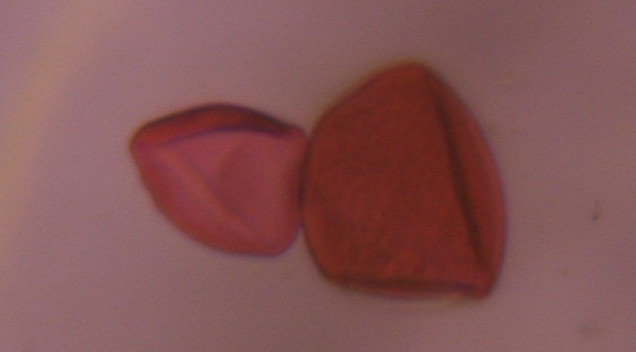 Unknown pollen under a microscope, verified by PollyMap