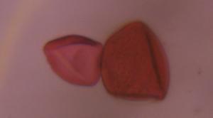 Unknown pollen under a microscope, verified by PollyMap