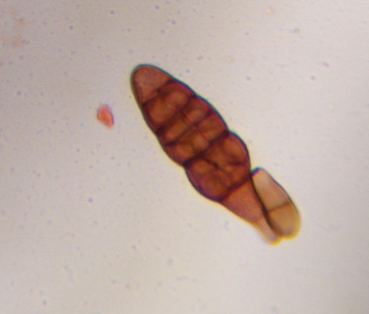 Alternaria mold spore under a microscope, verified by PollyMap