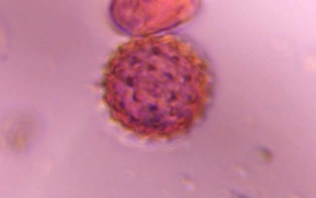 Asteraceae pollen under a microscope, verified by PollyMap