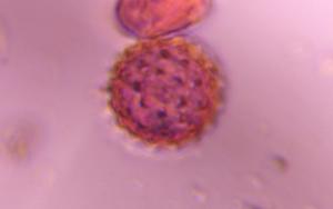 Asteraceae pollen under a microscope, verified by PollyMap